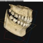 Tac-Dental-3D-MDI.jpg