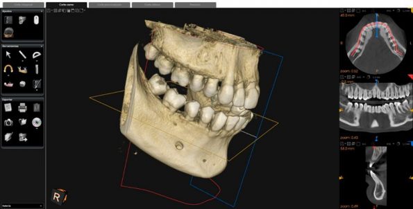 TAC 3D Dental