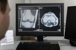 doctor-looking-at-ct-scans-on-computer
