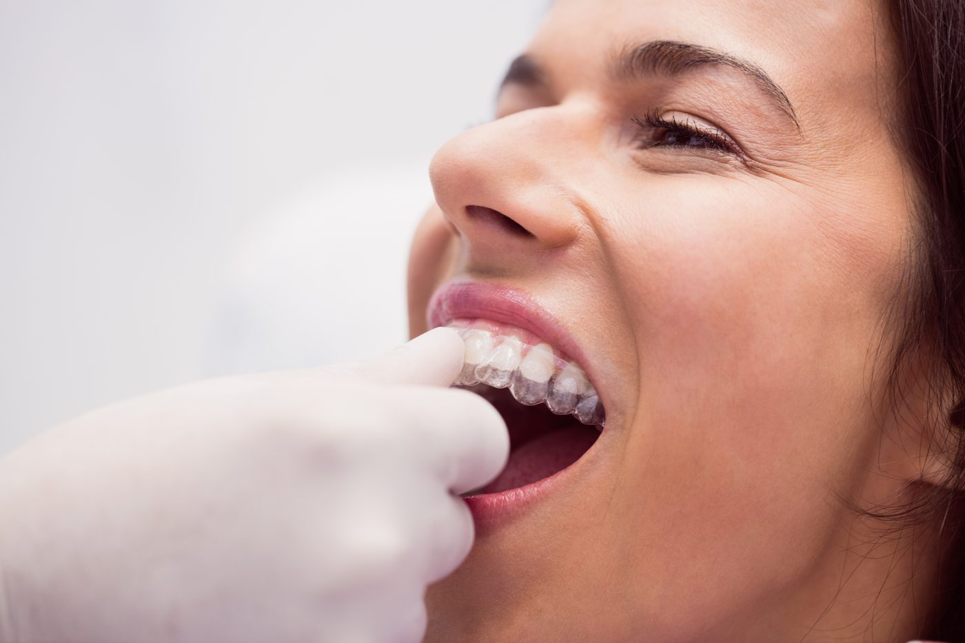 Tratamientos de ortodoncia: férula de descarga en Getafe o Leganés